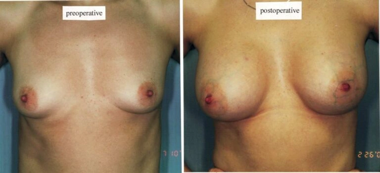 AAI_20240705_100736_008862-conv-1-768×350