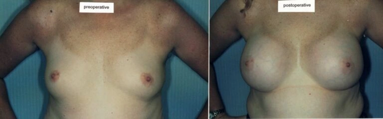 AAI_20240705_100845_008864-conv-2-768×239