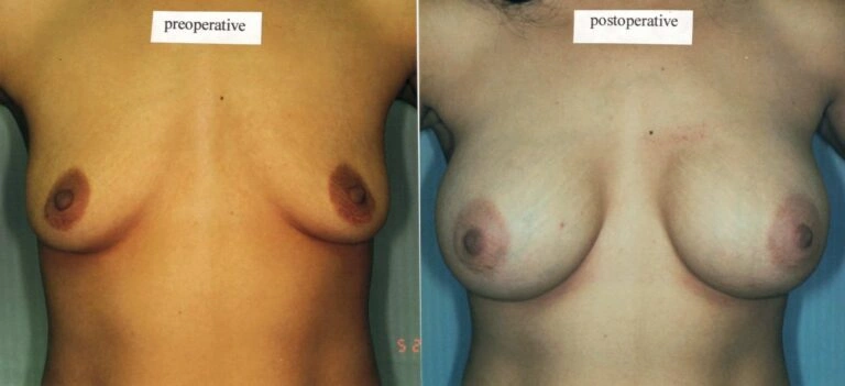 AAI_20240705_101020_008867-conv-1-768×351