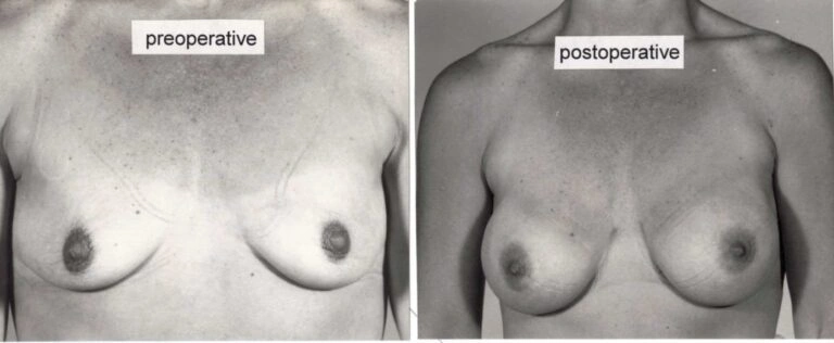 AAI_20240705_101048_008868-conv-1-768×316