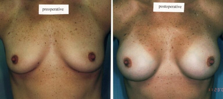 AAI_20240705_101720_008871-conv-1-768×343