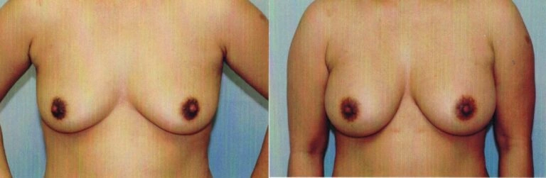 AAI_20240705_101745_008872-conv-1-768×251