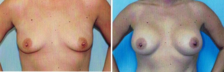 AAI_20240705_101816_008873-conv-1-768×249