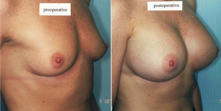 AAI_20240705_101844_008874-conv-1-768×386