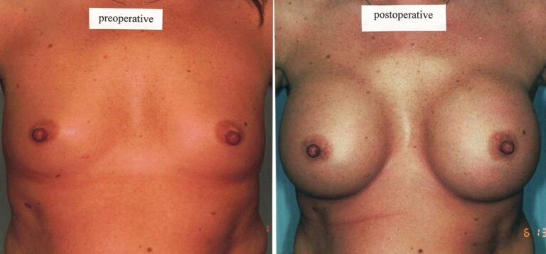 AAI_20240705_101936_008875-conv-1-768×358