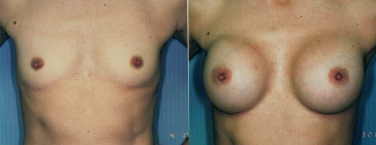 AAI_20240705_102011_008876-conv-1-768×297