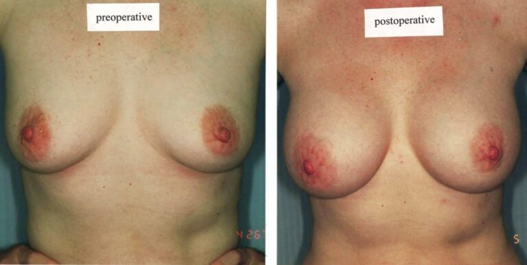 AAI_20240705_102043_008877-conv-1-768×387