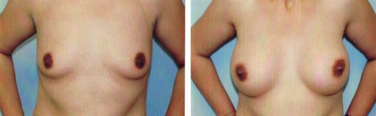 AAI_20240705_102237_008880-conv-1-768×238