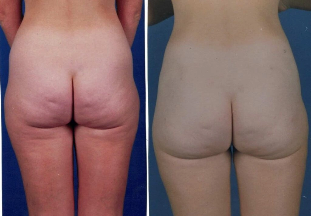 AAI_20240705_103720_008896-conv-1-1024×711