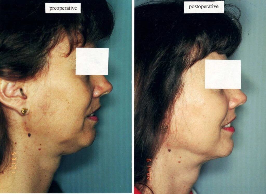 AAI_20240705_103801_008897-conv-1-1024×748