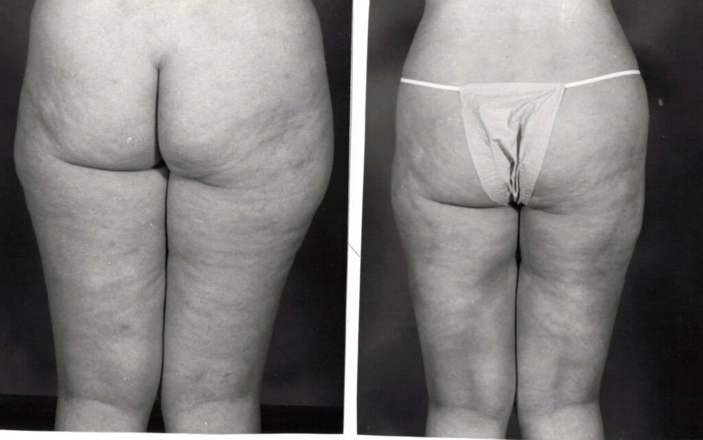 AAI_20240705_104537_008901-conv-1-1024×641