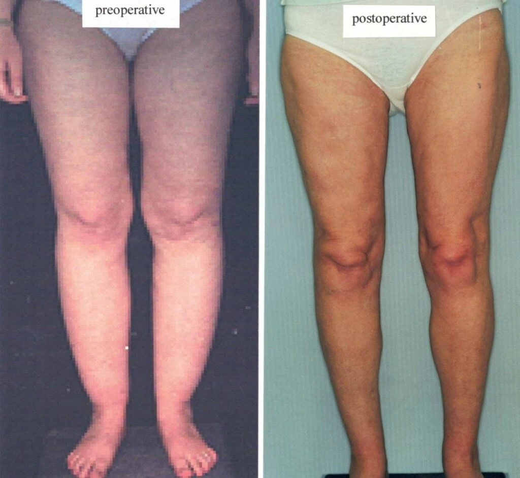 AAI_20240705_105414_008910-conv-1-1024×942