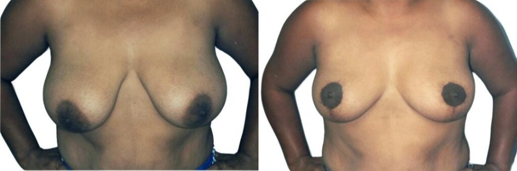 Untitled-image-13-1024×339