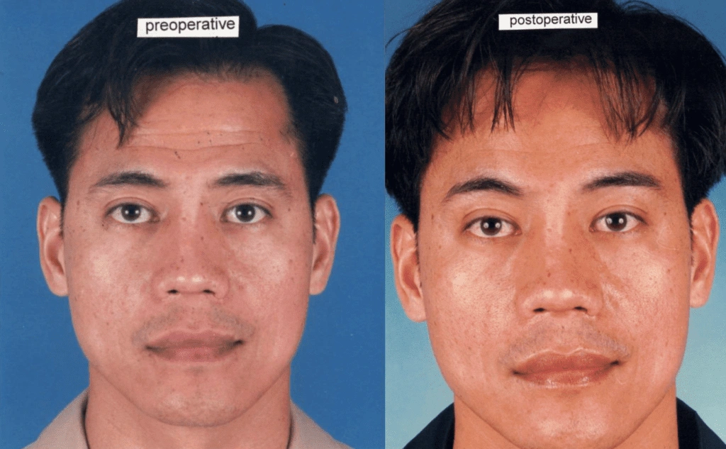 Untitled-image-16-1024×633