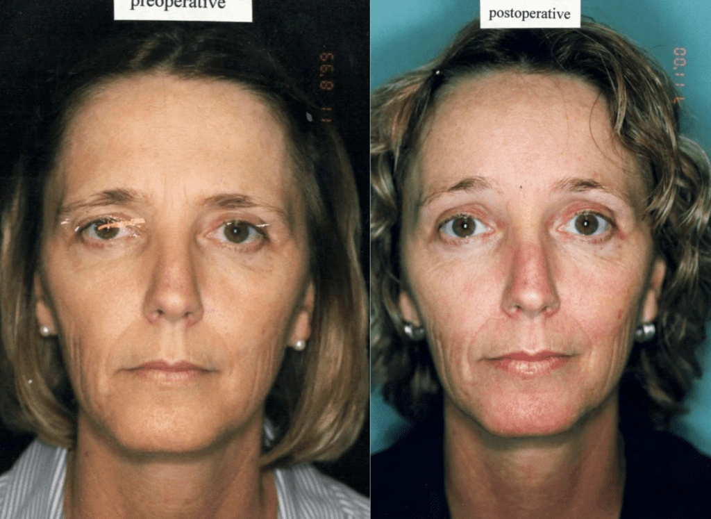 Untitled-image-17-1024×747