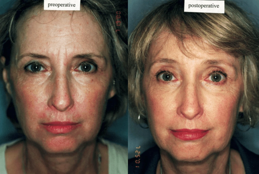 Untitled-image-19-1024×687