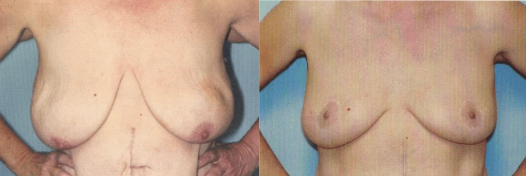 Untitled-image-61-1024×343