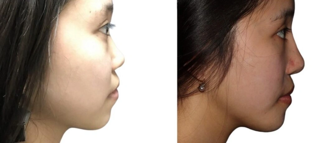 Untitled-image-8-1024×458