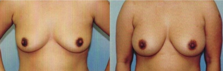 Untitled-image-81-768×247