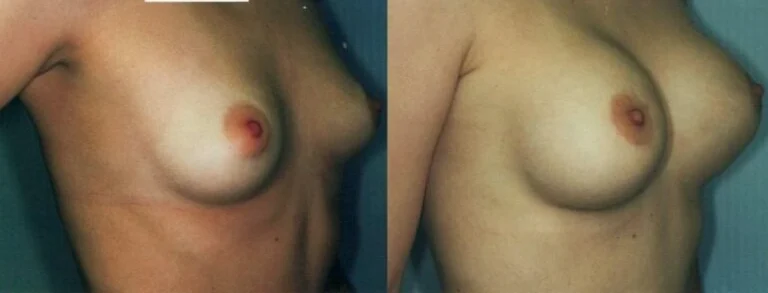 Untitled-image-9-10-768×336