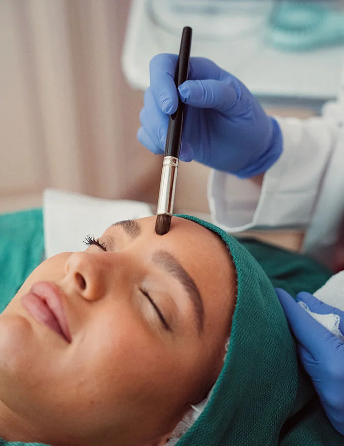 A close-up of a medical professional’s hand in a blue glove using a fine brush to apply a chemical peel solution to a patient’s forehead.