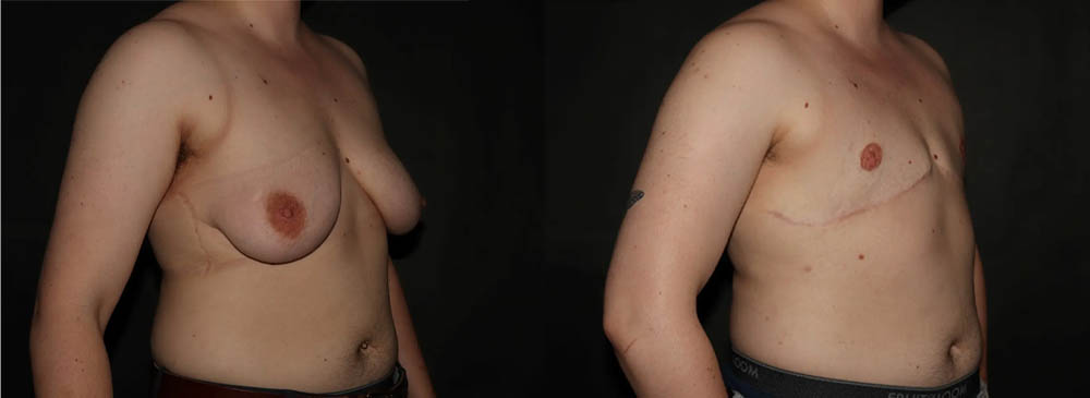 TransgenderPS (3)