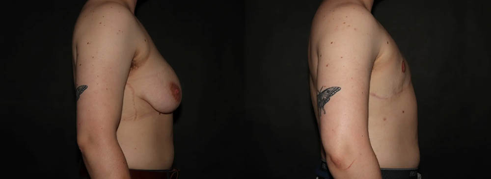 TransgenderPS (4)
