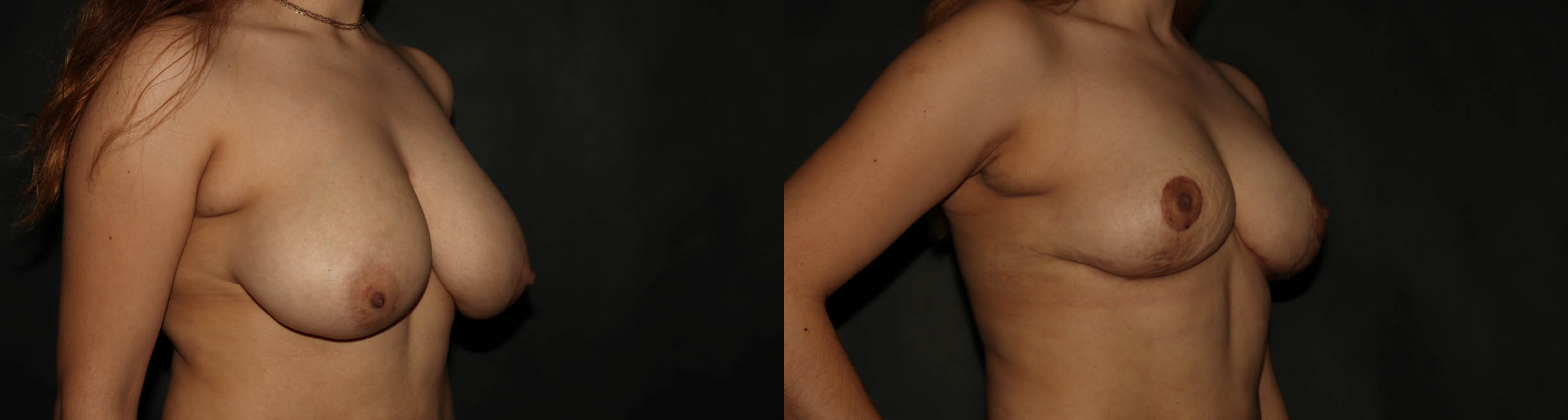breast red (9)